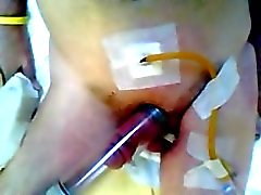 Cbt penis pump